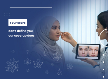 Stretch Marks & Acne Scars: 5 Ways Scar Coverup Services in Ras Al Khaimah Work Wonders for Your Skin