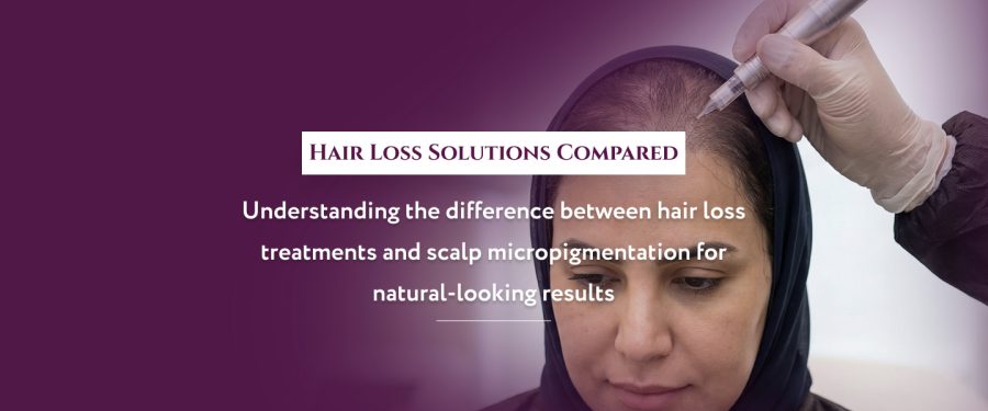Hair Loss Treatments vs Scalp Micropigmentation: What Works for Men and Women in the UAE